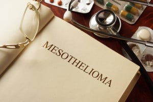 Lawyers For Mesothelioma