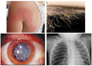 Health Conditions
